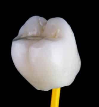 corona-dental