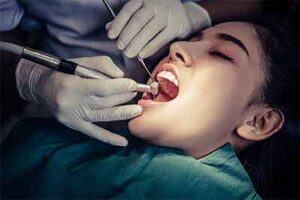 caries dental como prevenirla