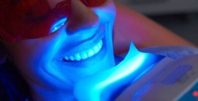 blanqueamiento de dientes con luz led resultados