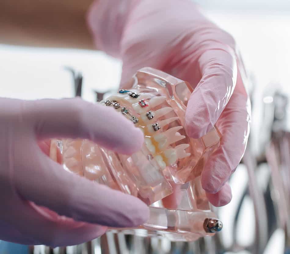Consejos para cuidar tu prótesis dental removible